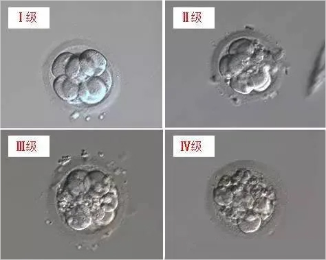 试管婴儿胚胎分级是怎么回事？